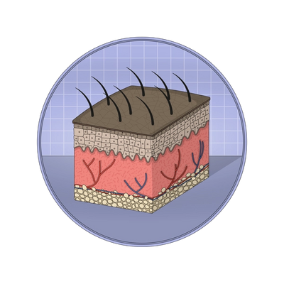 Illustration showing the skin's dermis and epidermis layers.